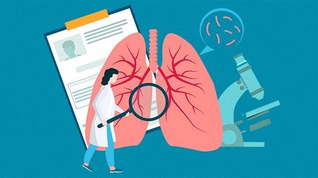 تاثیر عوامل ژنتیکی بر خطر سرطان ریه سیگاری ها