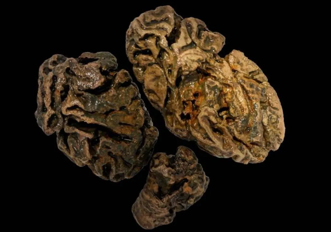 مغزهای باستانی 12 هزار ساله چگونه هنوز نپوسیده‌اند؟