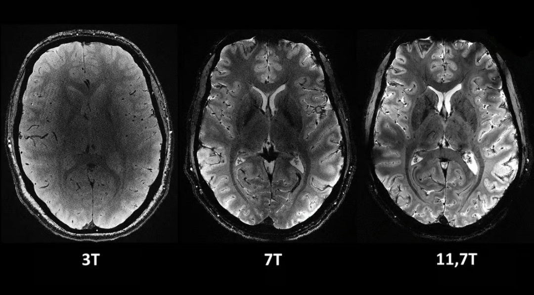 قدرتمندترین دستگاه MRI جهان اولین اسکن مغزی خیره‌کننده را ثبت کرد.
