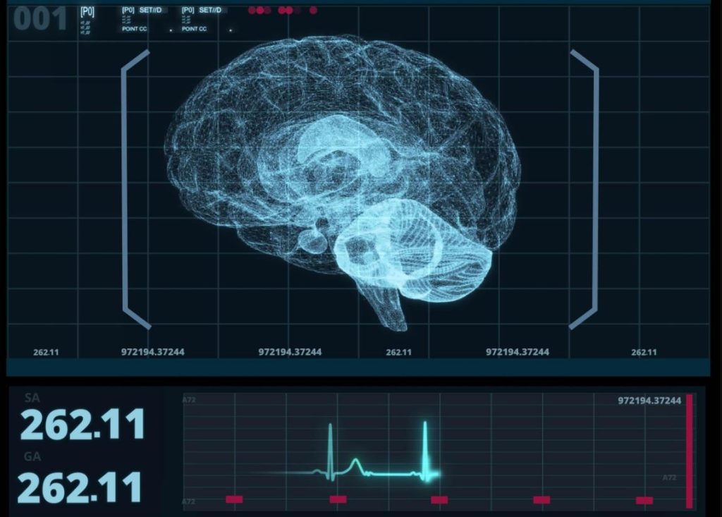 هوش مصنوعی جدید قادر به تشخیص سریع اختلالات مغزی در چند ثانیه